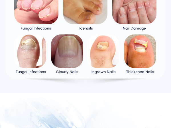 Common visual nail changes and texture patterns